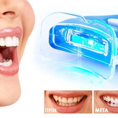 Μασελάκι λεύκανσης δοντιών με Τζελ -Πρωτοποριακό κιτ καλαισθησίας